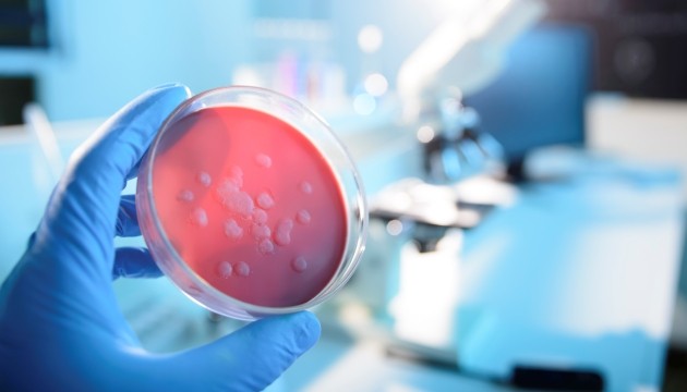 Bacteriekweek in een laboratoriumschaal, hand met handschoen.